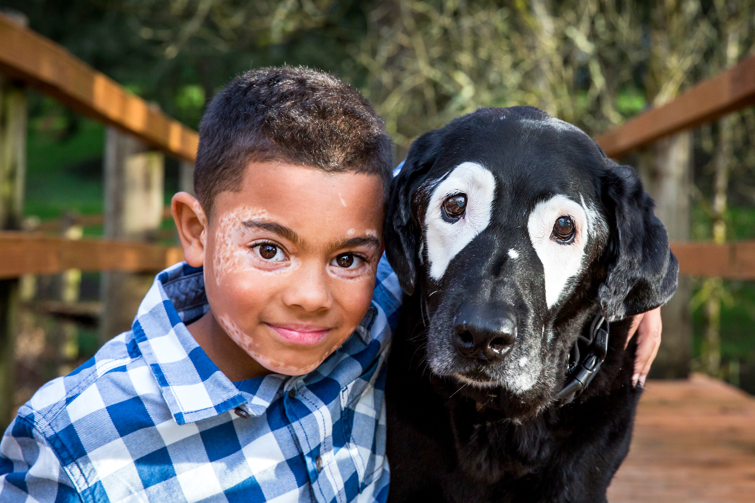 Rowdy the Dog with Carter, who both have vitiligo